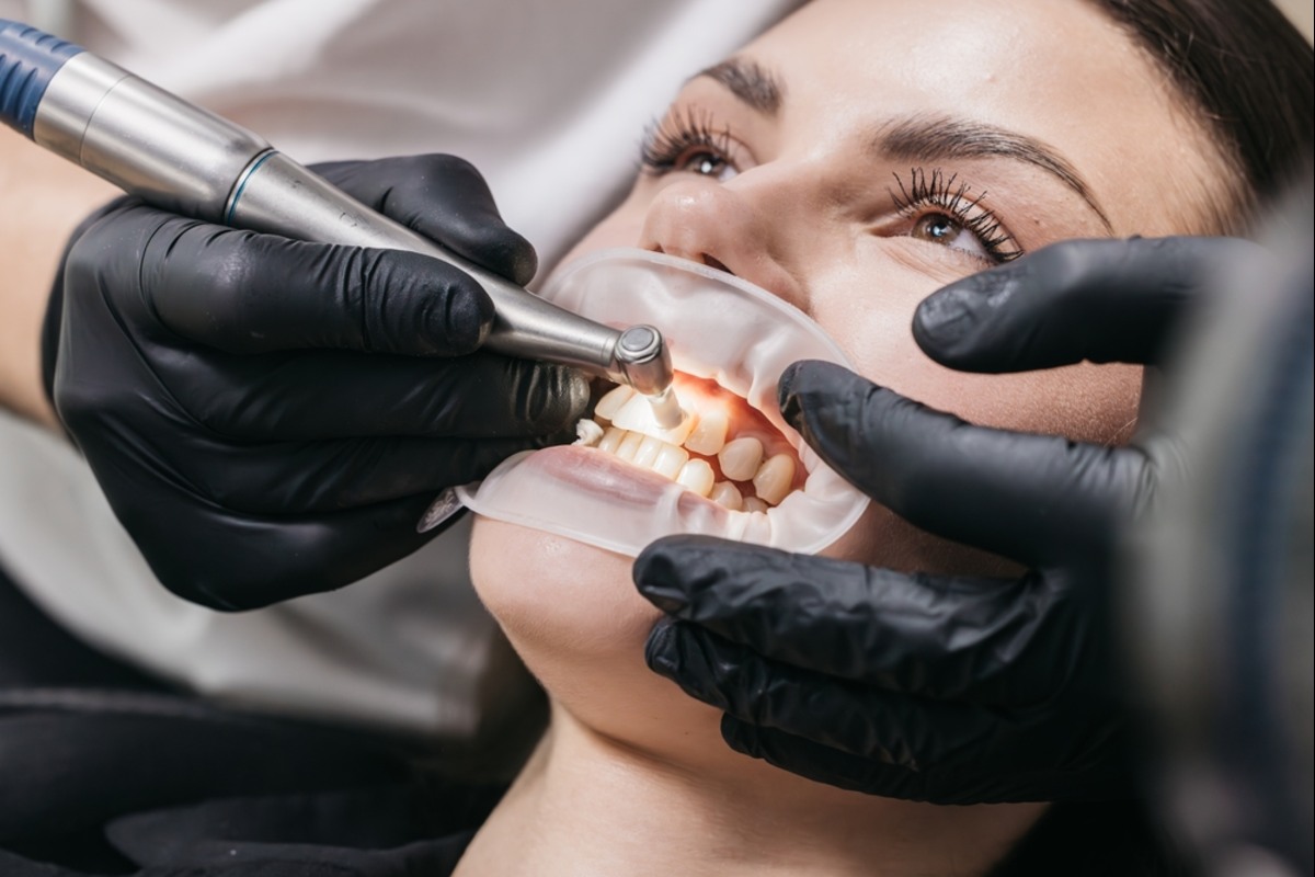 dentist performing professional teeth cleaning