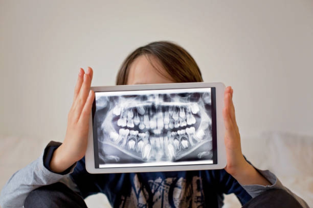are-digital-dental-x-rays-better-than-traditional
