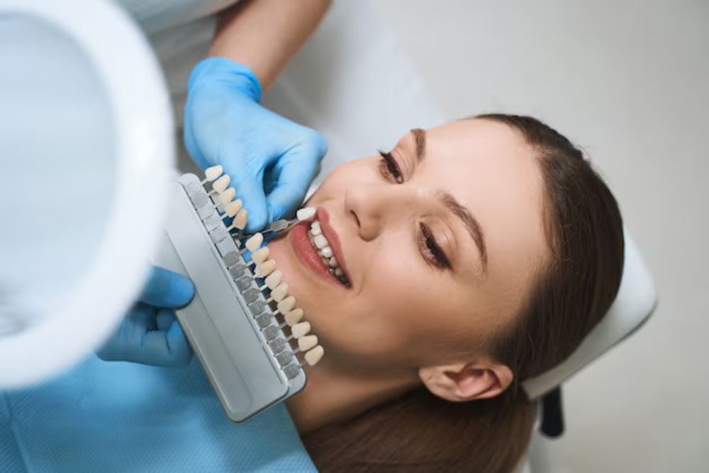 are-porcelain-veneers-worth-it-what-patients-should-know