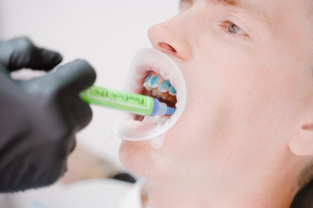 do-i-need-fluoride-treatment-a-dentists-guide-to-stronger-teeth