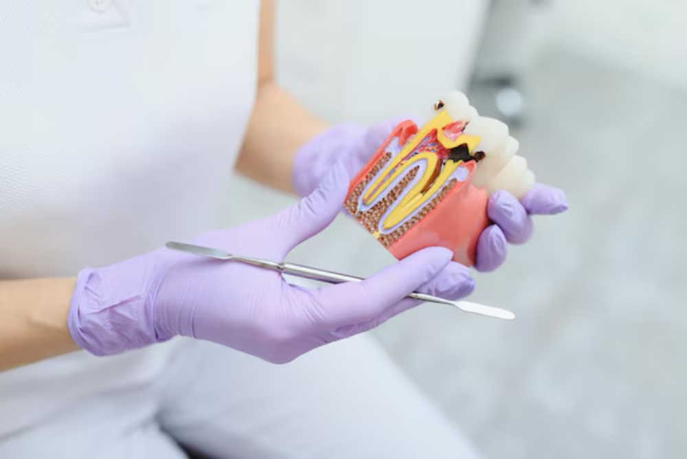 Restore your smile with gentle root canal treatment in Nanaimo. Our experienced team offers effective, comfortable root canal care near you for lasting relief.